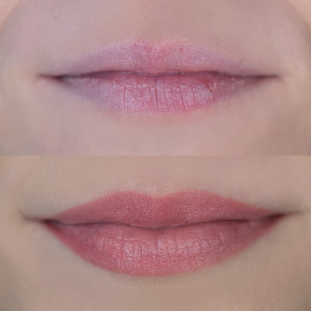 前和后30天唇脸红