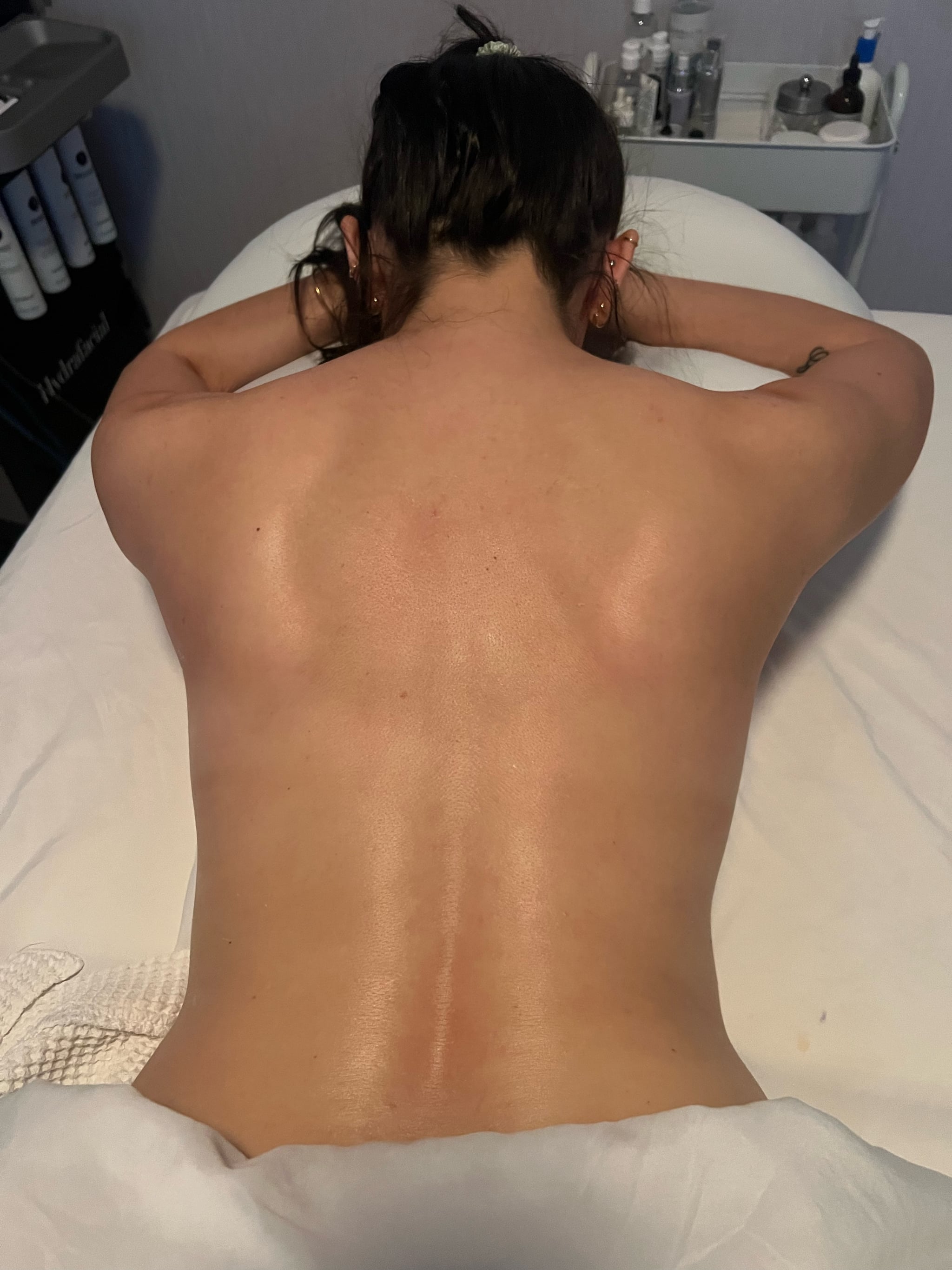 what is a back facial or bacial