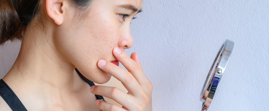 Editors Share Their Favorite Acne Treatments Under $20