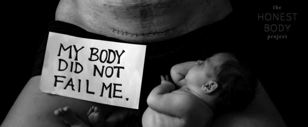Honest Body Project Stapled C-Section Scar Photo Shoot