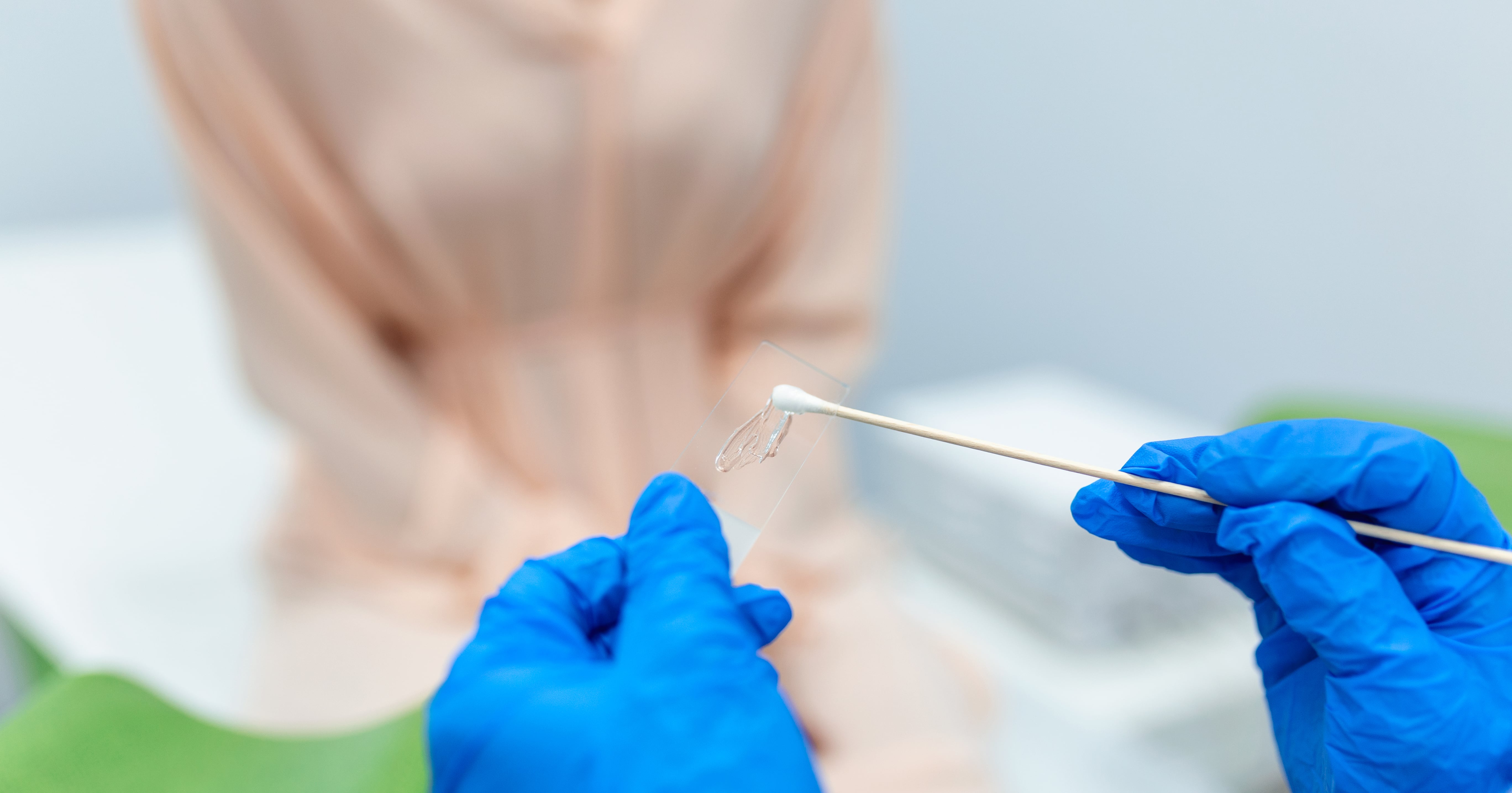 What to Know About Self-Collection HPV Testing