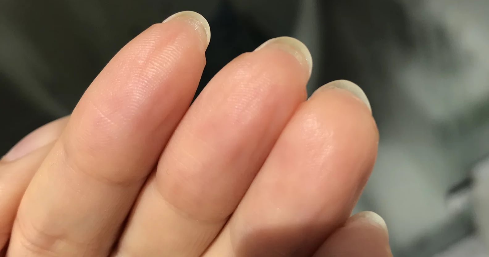 Hyponychium: Experts Explain Skin Growing Under Your Nails