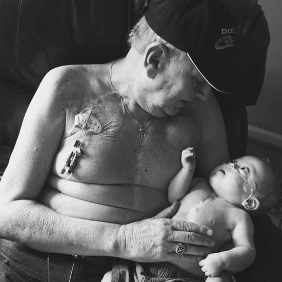 Grandfather and Grandson With Matching Heart Surgery Scars