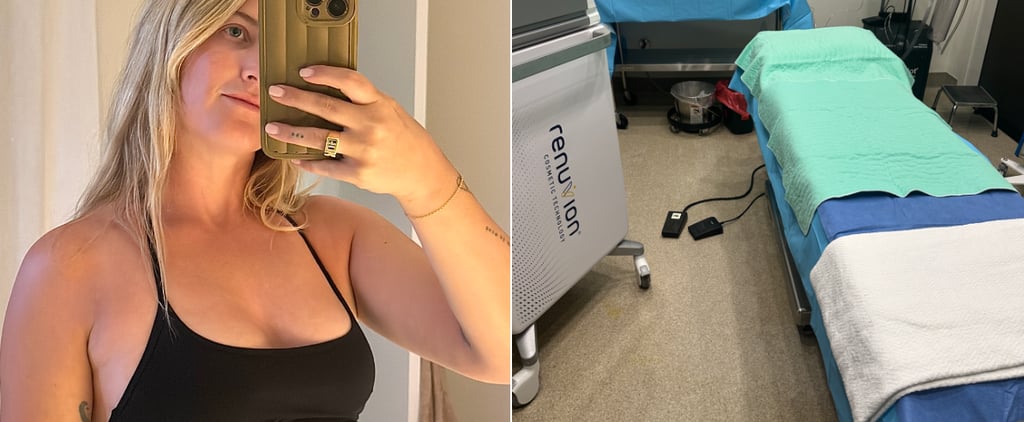 I Tried AirSculpt Breast Augmentation: See Before and Afters