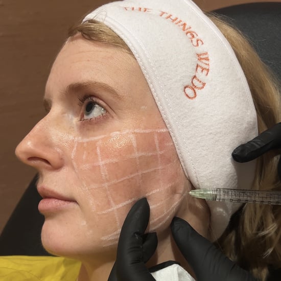 I Tried Skinvive Filler: See Photos