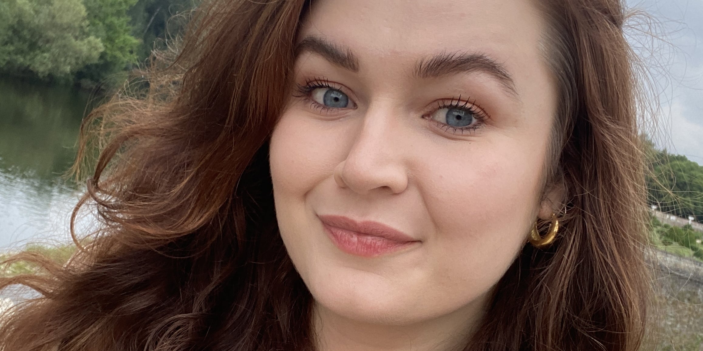 I've Had Eczema My Entire Life — Here's What It's Really Like to Live With It