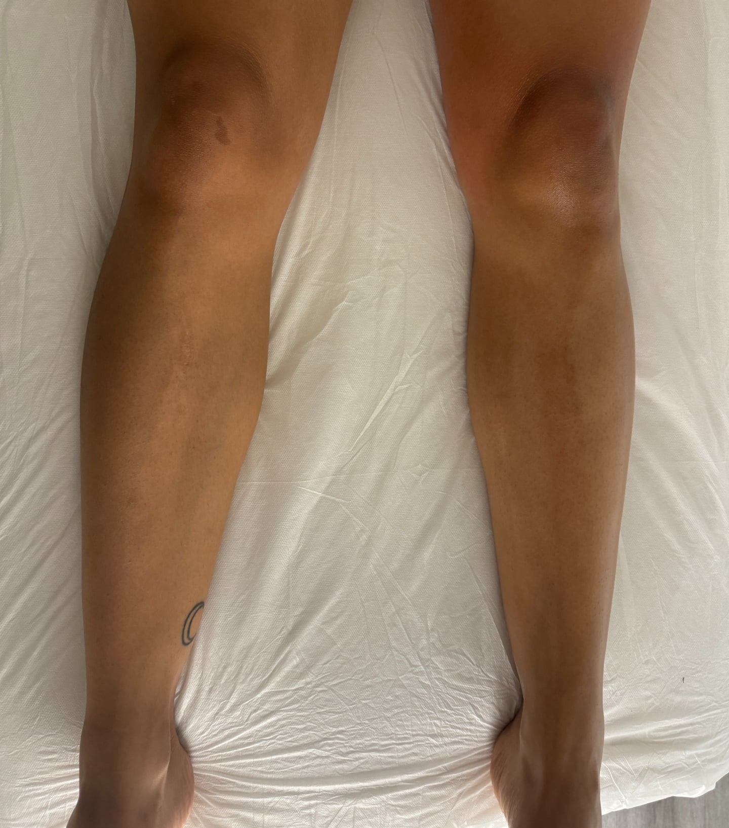 lymphatic drainage massage editor experiment