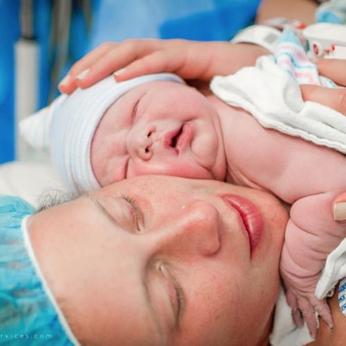 What Is a Gentle C-Section?
