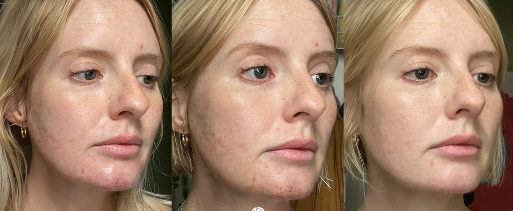 Ellacor Before and After Photos With Review