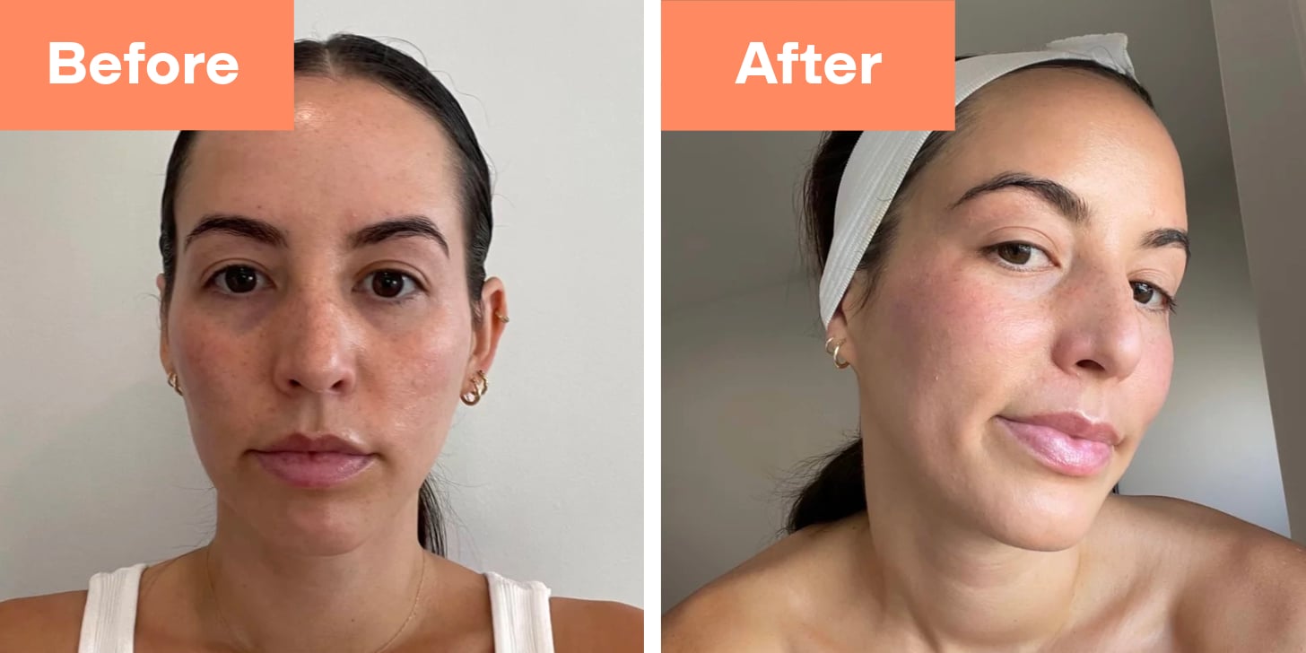 diamond glow before and after