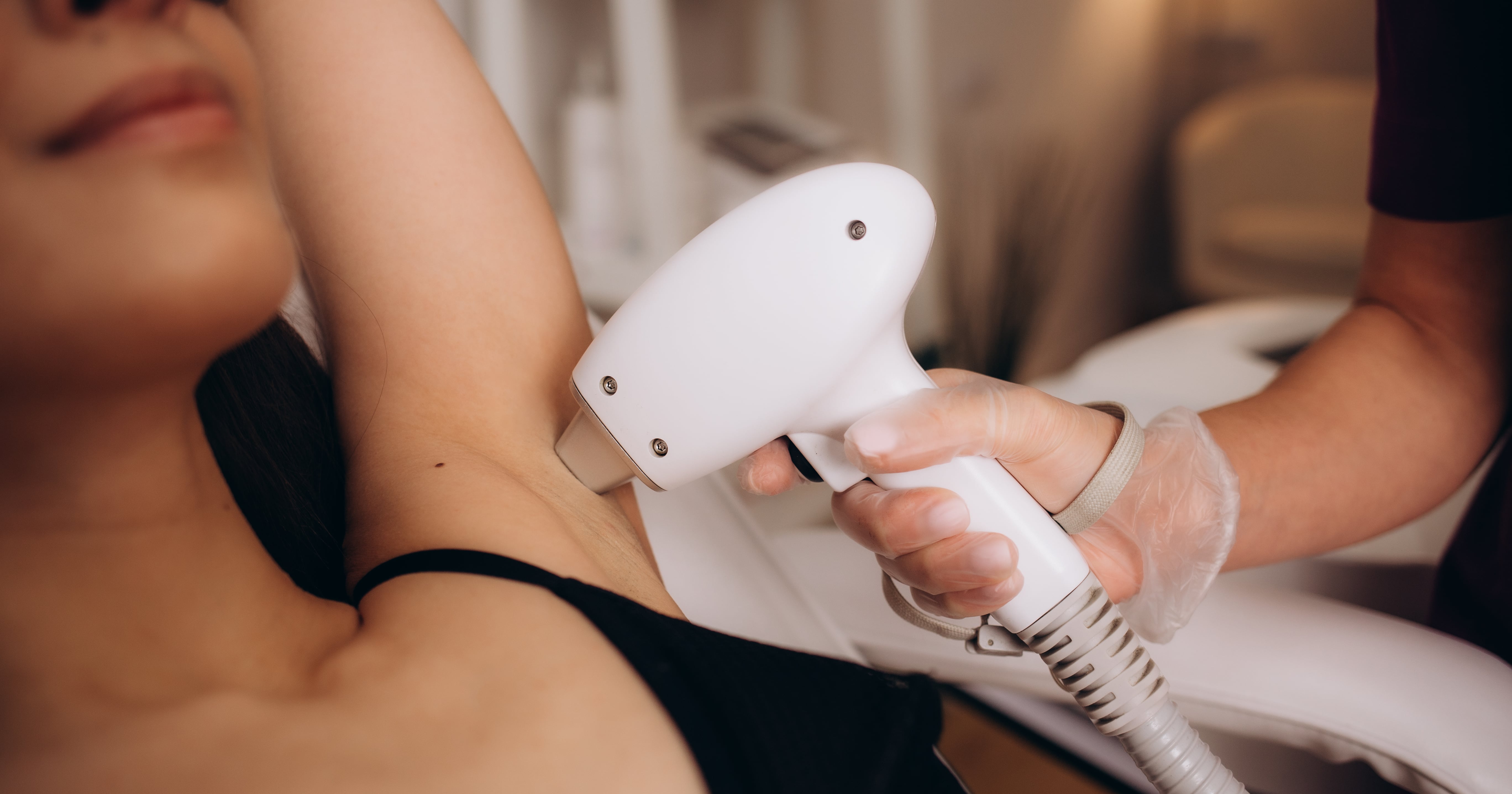 Your Guide to Underarm Laser Hair Removal: Cost, Pain, Effectiveness, and More