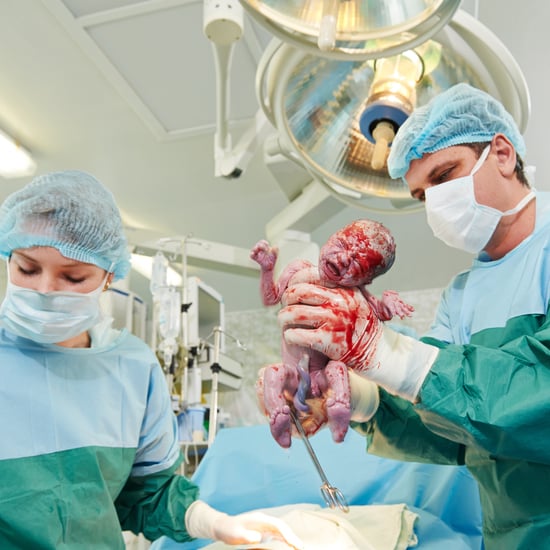 How to Avoid an Unnecessary C-Section