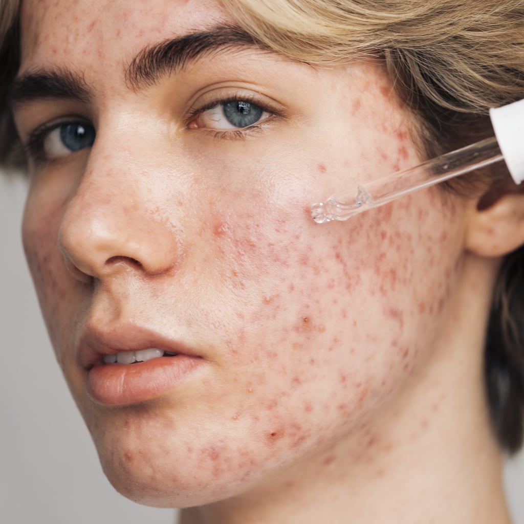 How to Unclog Pores, According to Doctors and Aestheticians