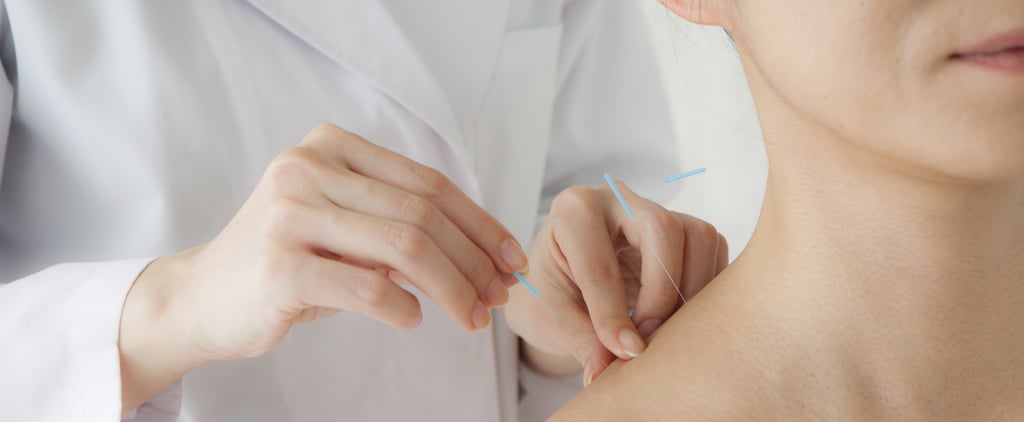 Acupuncture Side Effects to Know About Before Your Treatment