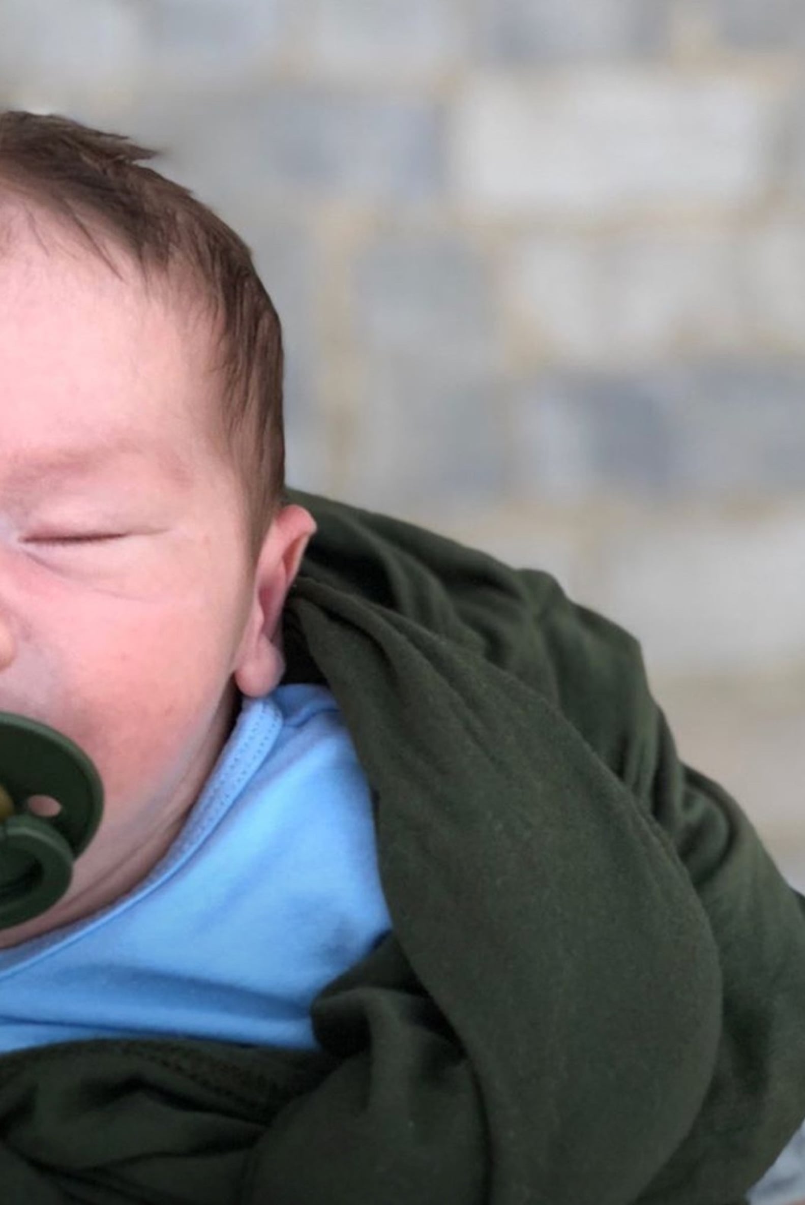 Comprehensive Guide To Crew Gaines Syndrome Everything You Should Know