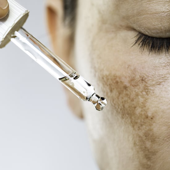Melasma Treatment and Causes From Doctors