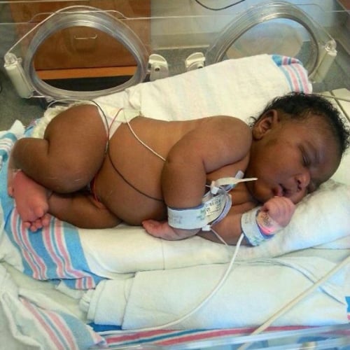 14-Pound Baby Born in Florida