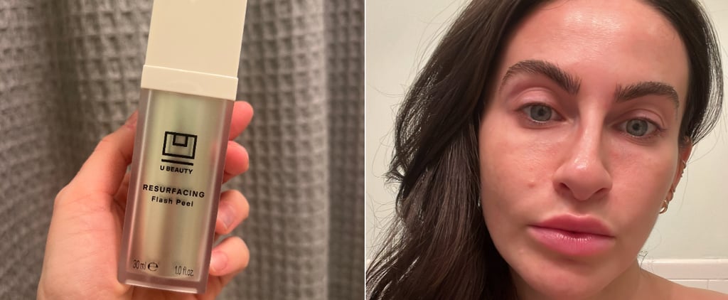 U Beauty Resurfacing Flash Peel Review With Photos