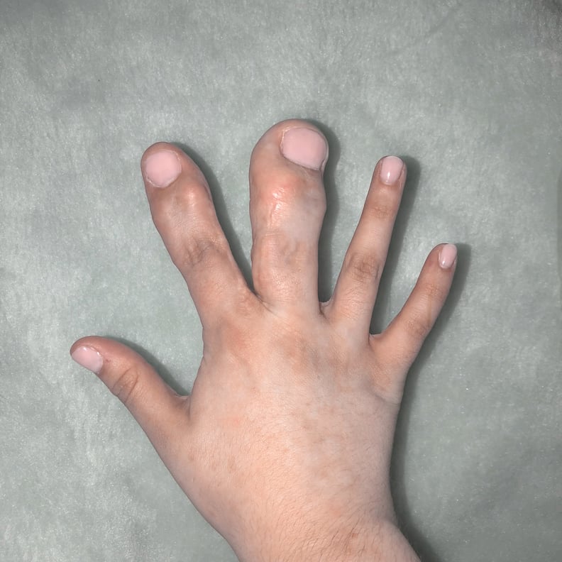 These are my Fingers