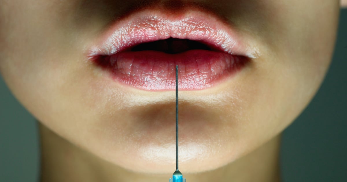 I Got A Lip Flip, TikTok's LipFiller Alternative POPSUGAR Beauty UK
