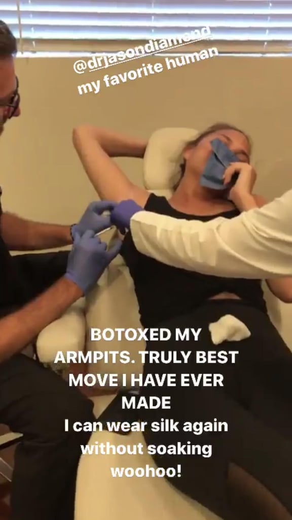 Chrissy Teigen Getting Botox in Her Armpits