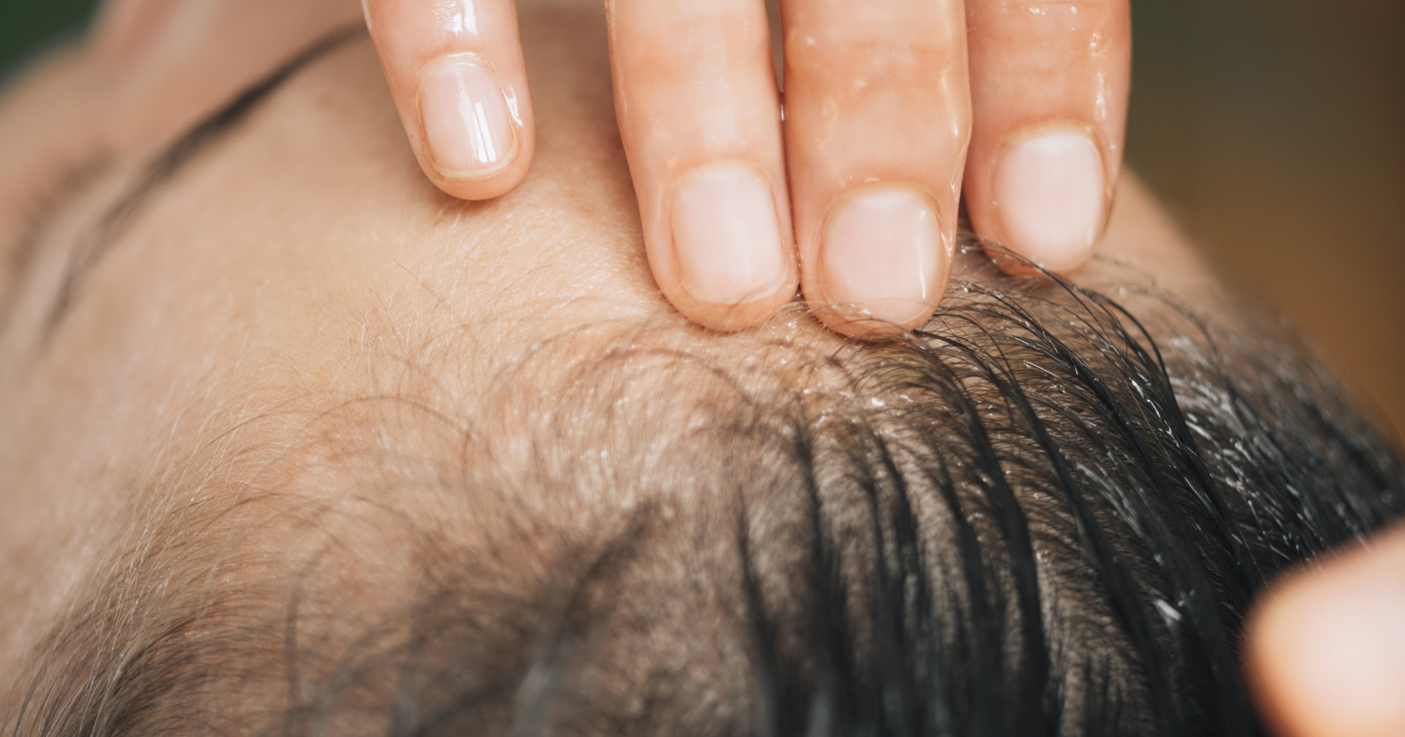 The Dangers of “Hair Cracking,” TikTok’s Latest Fascination