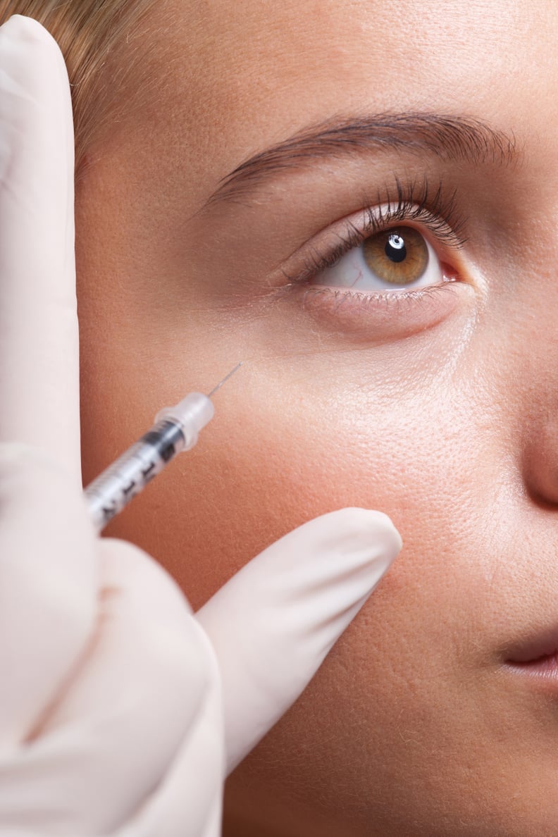 Restylane Eyelight is the first FDA-approved dermal filler for the undereye area.