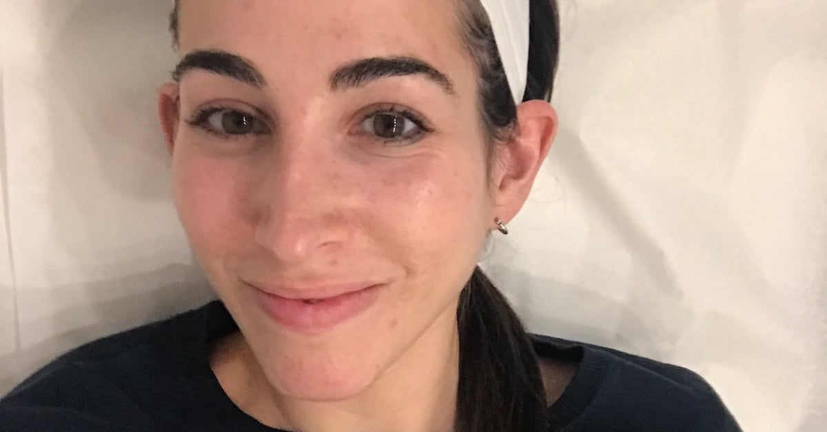 What Is a Jet Peel Facial? POPSUGAR Beauty