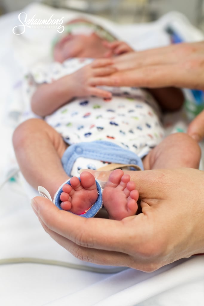 Moms Skin-to-Skin Bonding With Their Newborns in the NICU