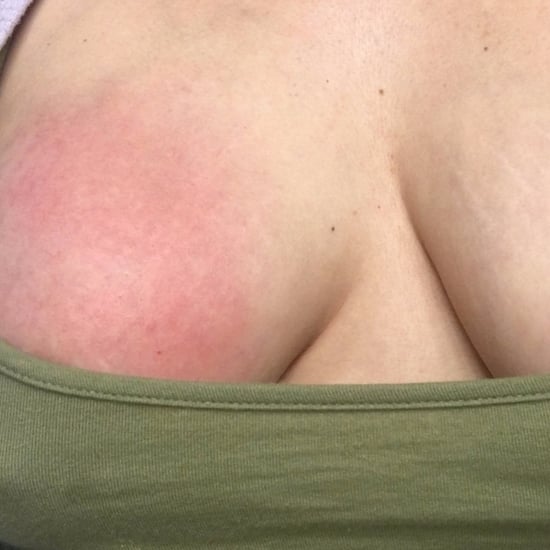 Does Breastfeeding Hurt?