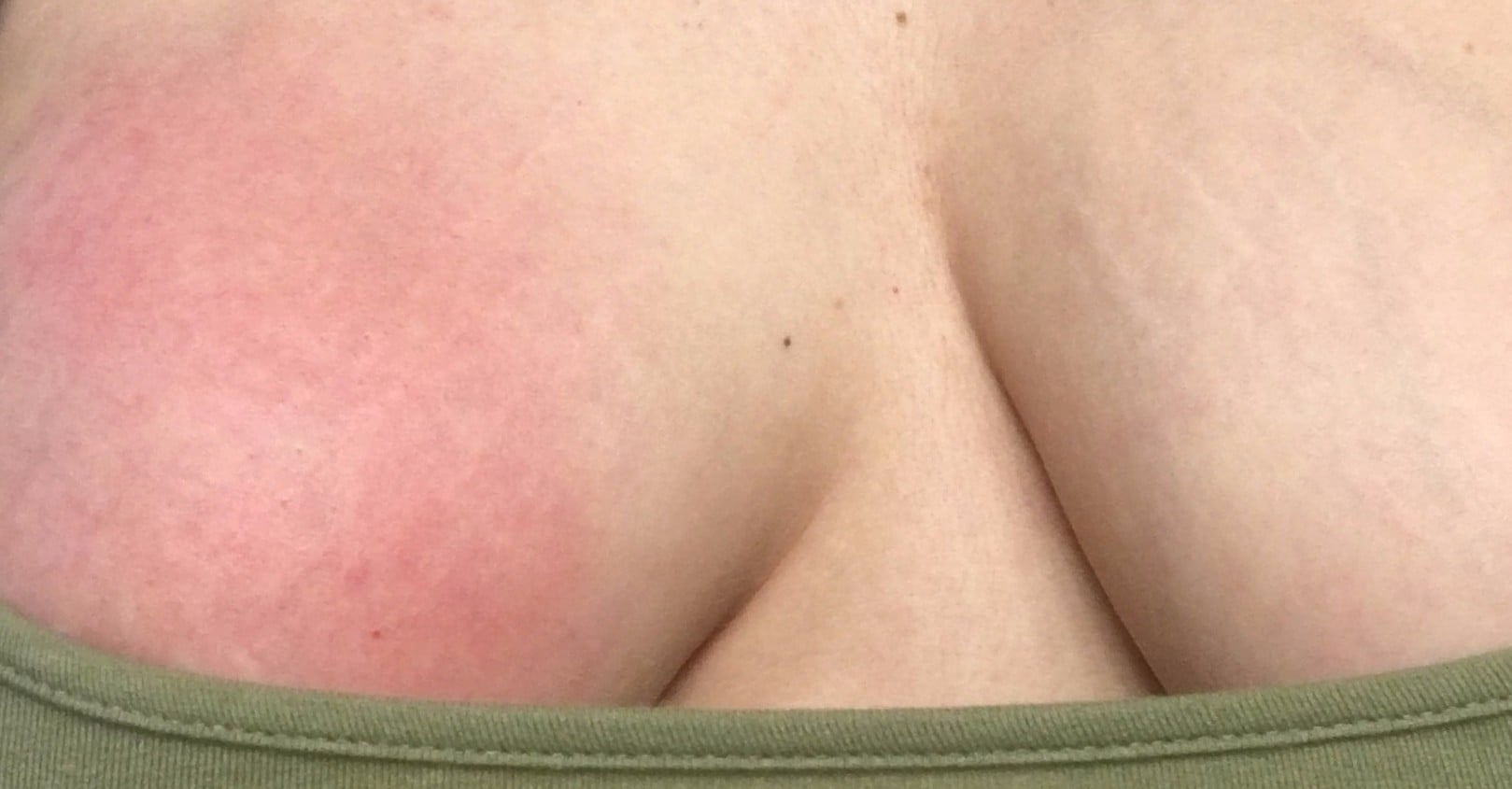 PMS boobs = Look so GOOD but hurt so BAD! Picture Courtesy