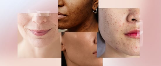 What Is My Skin Type? Take This Quiz