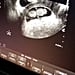 Joanna Gaines Ultrasound Video