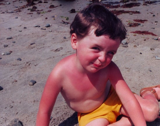 10 Ways to Soothe a Sunburn