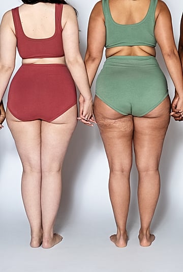 Why Cellulite Is So Tricky to Treat