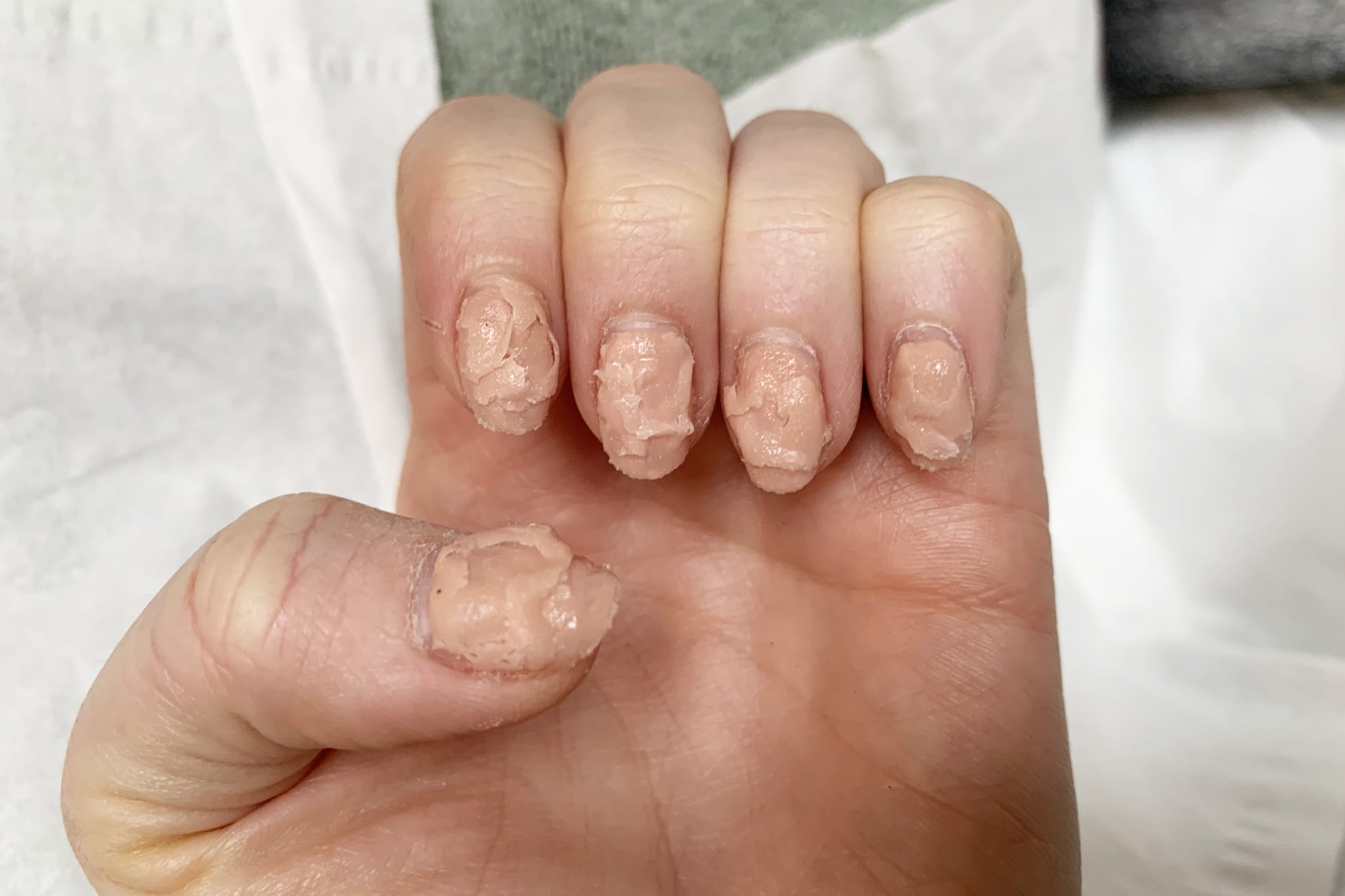 How to get rid of Stained Nails | Mersi Cosmetics