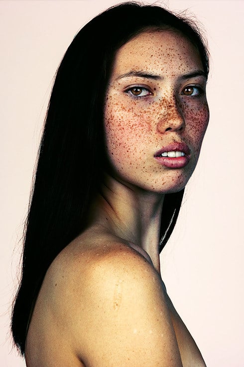 Photos of People With Freckles