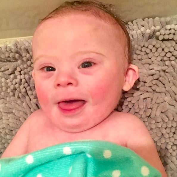 Photos of Babies With Down Syndrome