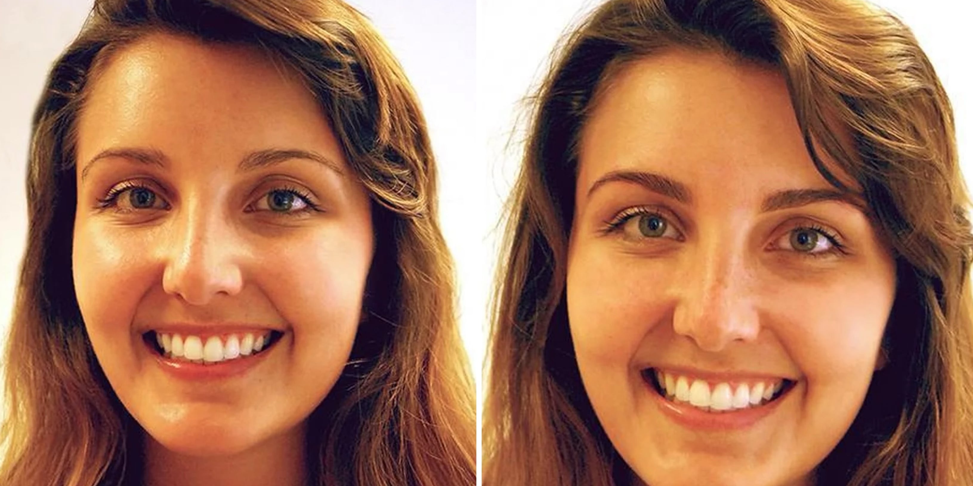 I Tried Eyebrow Extensions: See Photos | POPSUGAR Beauty - Vimarsana News