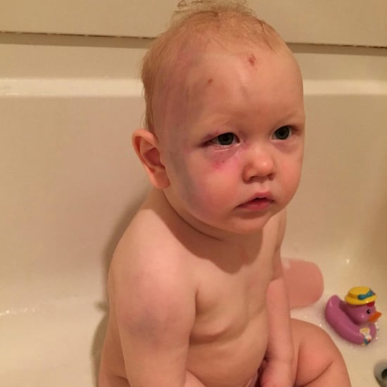 Babysitter Gets Away With Abusing Baby