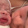A Mom With Dwarfism Shares What It's Like to Give Birth to a Baby With the Same Diagnosis