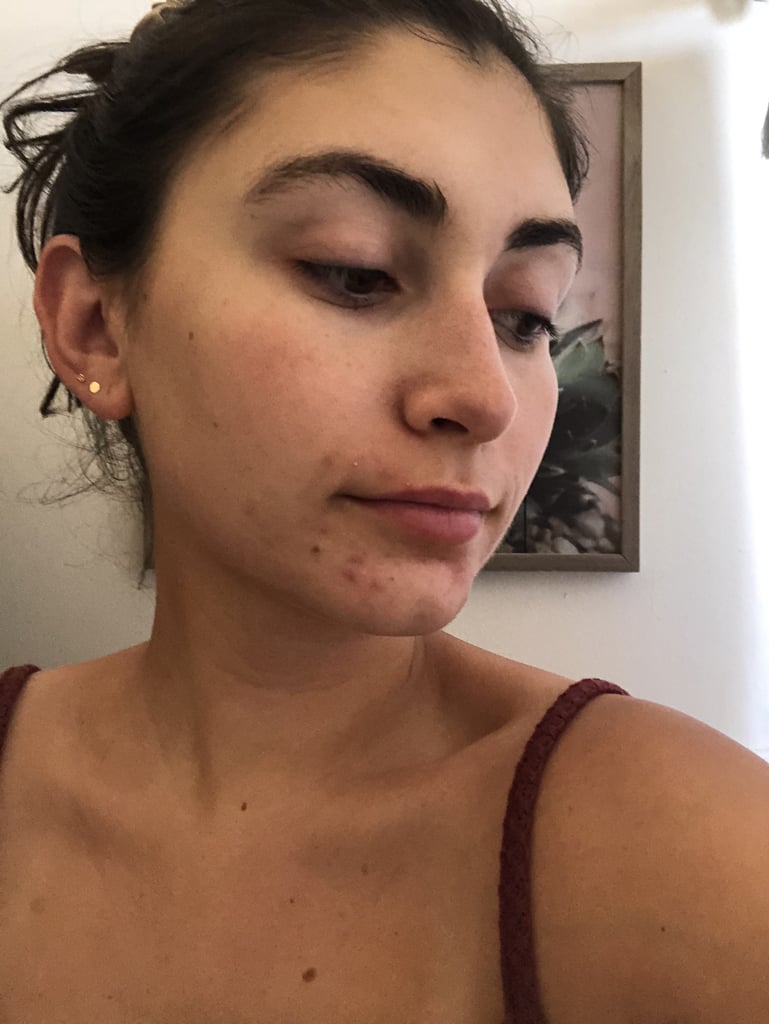 Now back to my own skin-care experiment: because anti-aging isn't one of my main skin-care concerns yet, I gave the Lightstim device with blue light a try because breakouts, on the other-hand, definitely are a concern. I srtruggle with hormonal acne around my jaw and chin, which has only been aggravated lately by wearing a mask.
