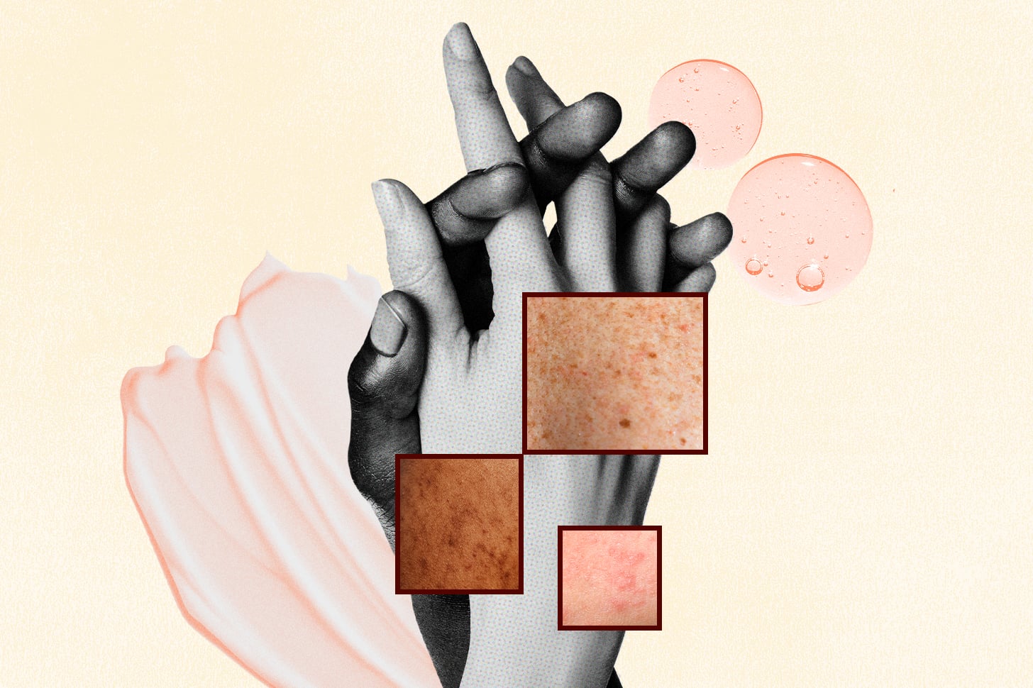 Real Couples Share How Chronic Skin Conditions Impact Their Relationships
