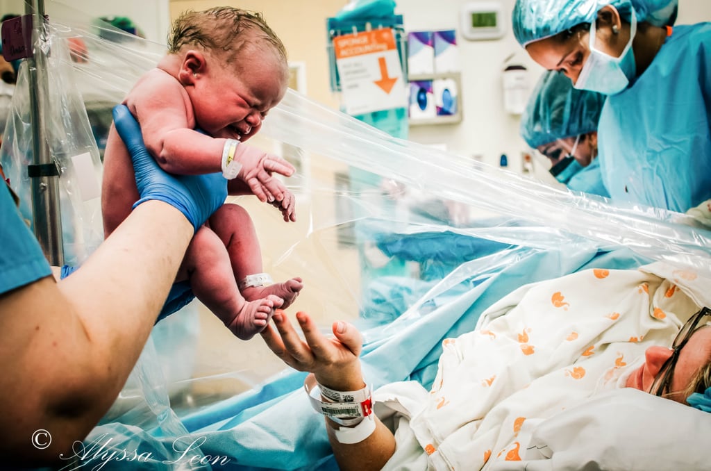 Clear Drapes Family Centered C-Section Birth Photos