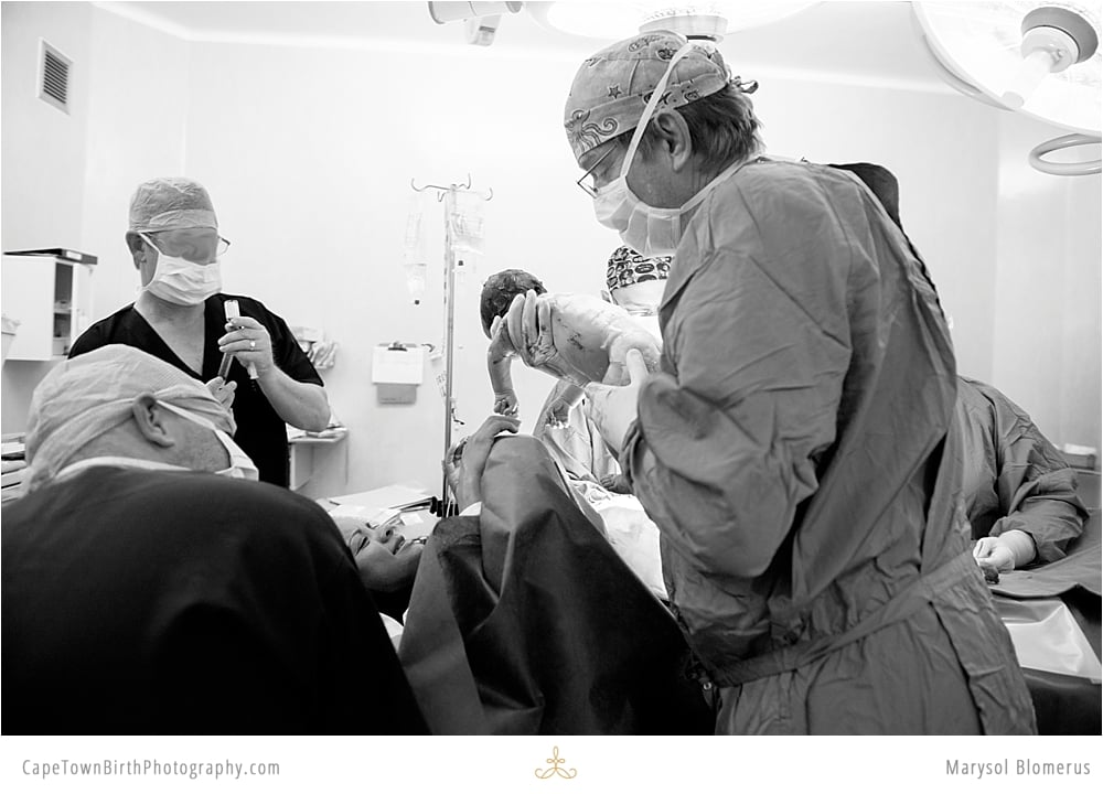 C-Section Birth For Blended Family in South Africa