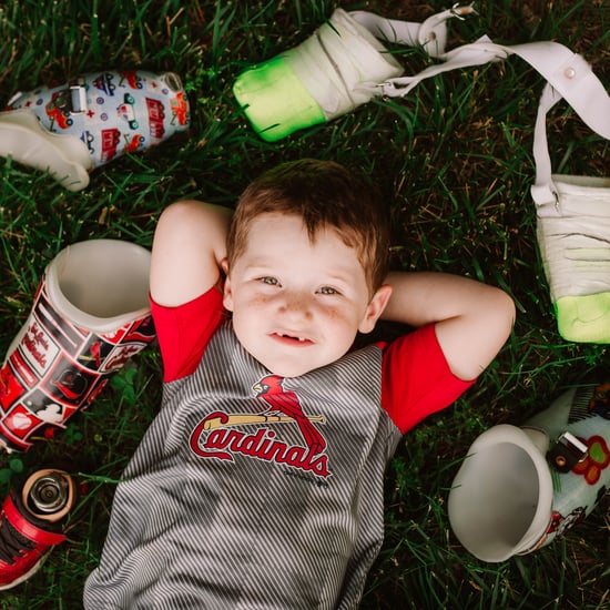 Photo Shoot of Toddler Who Lost Both Legs