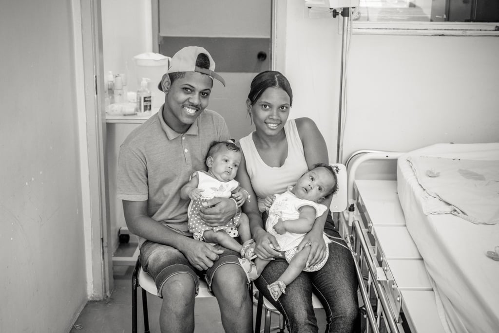 Conjoined Twins Are Separated and Photographed