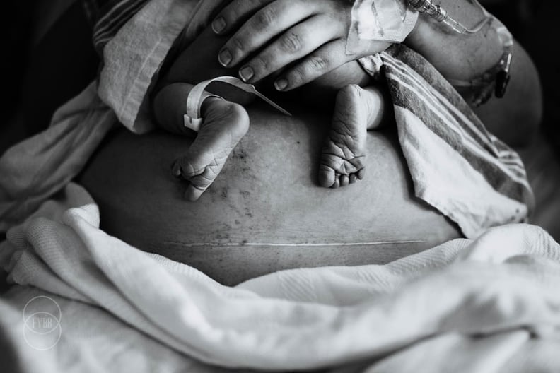 These Stunning 2018 Birth Photos Are Going to Cause Your Jaw to Drop to the Floor