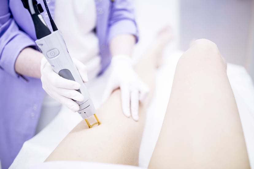 Young woman getting laser hair removal treatment on leg, close-up.