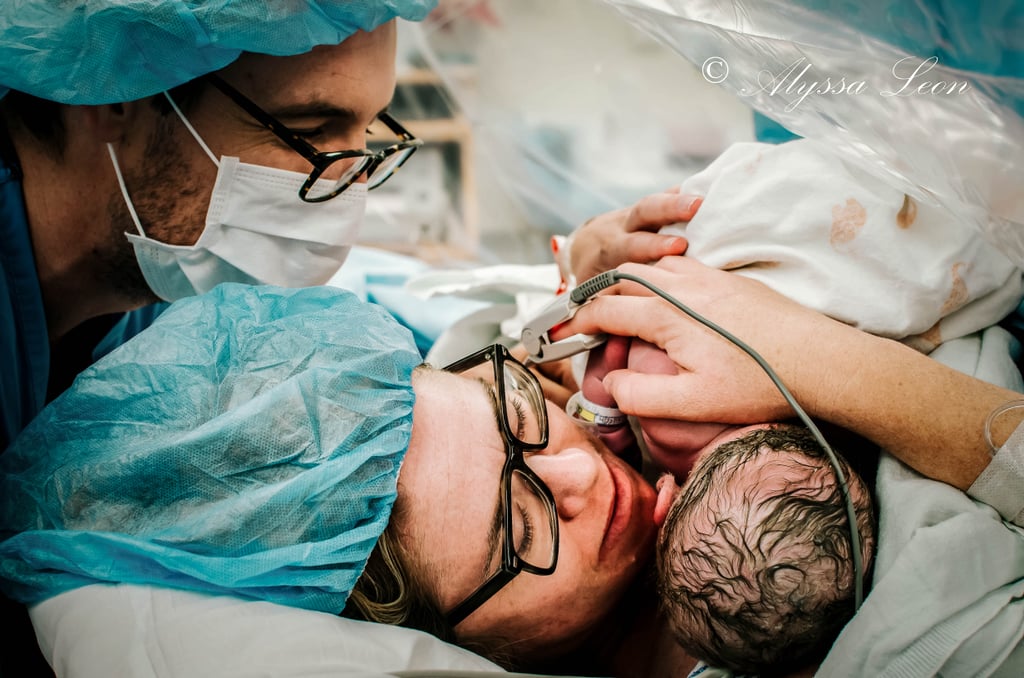 Clear Drapes Family Centered C-Section Birth Photos